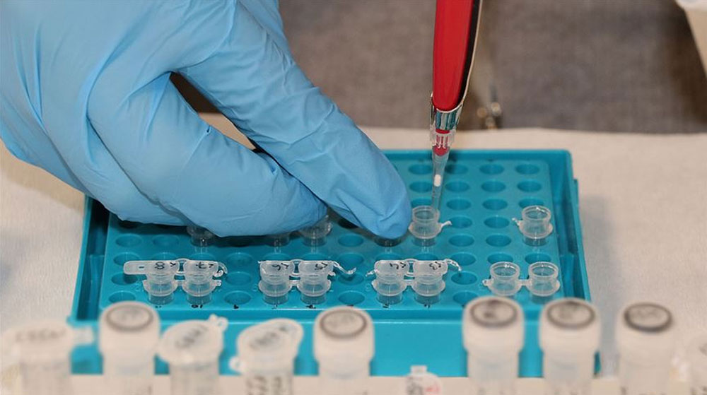 Bazı Kanser Türlerini Semptomlar Görülmeden Birkaç Yıl Önce Tespit Eden Test Geliştirildi