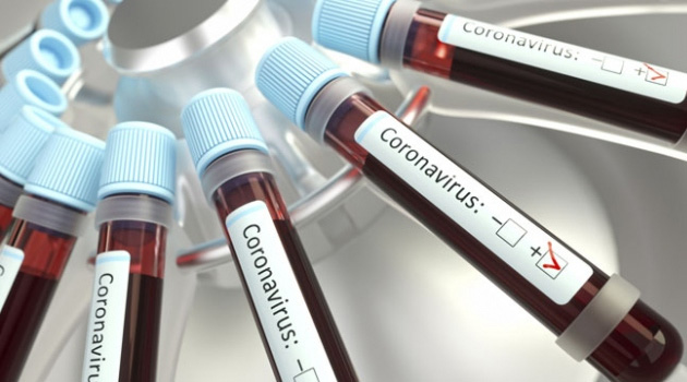 Suriye'de koronavirüs kaynaklı ilk ölüm gerçekleşti