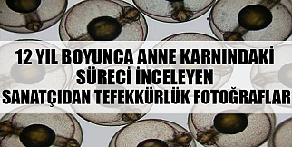 12 Yıl Boyunca Anne Karnındaki Süreci İnceleyen Sanatçıdan Tefekkürlük Fotoğraflar