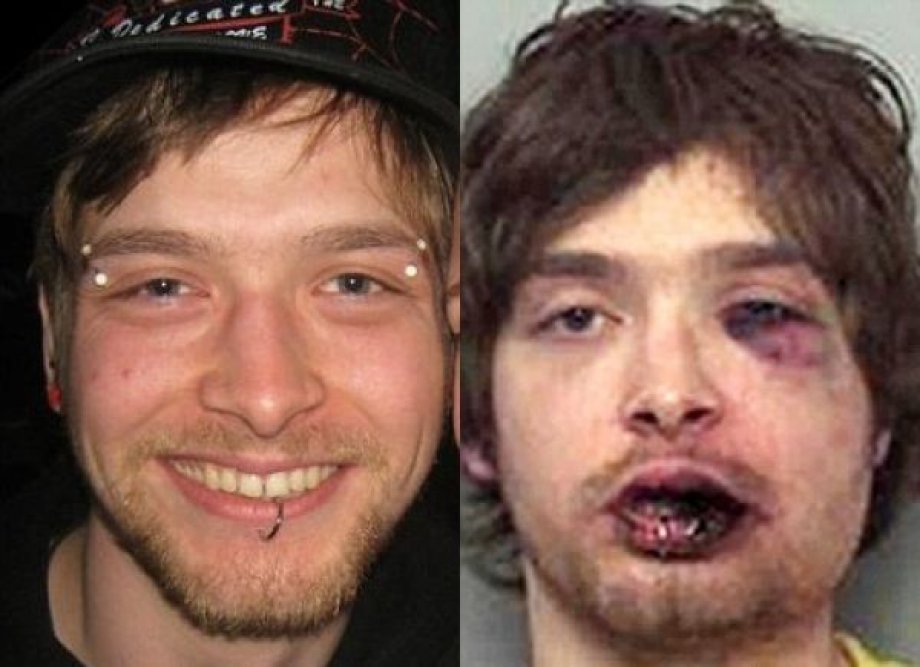 İşte Dövüşçülerin Maç Sonu Halleri (Foto Galeri) +18
