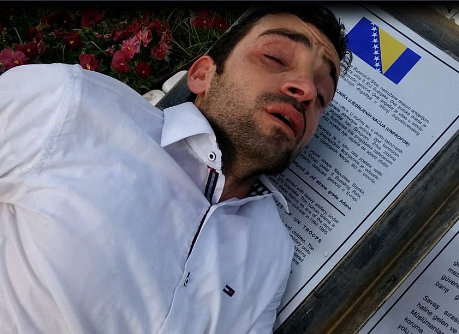 Furkan Vakfı Mensuplarına Acımasız Müdahale Anından Kareler