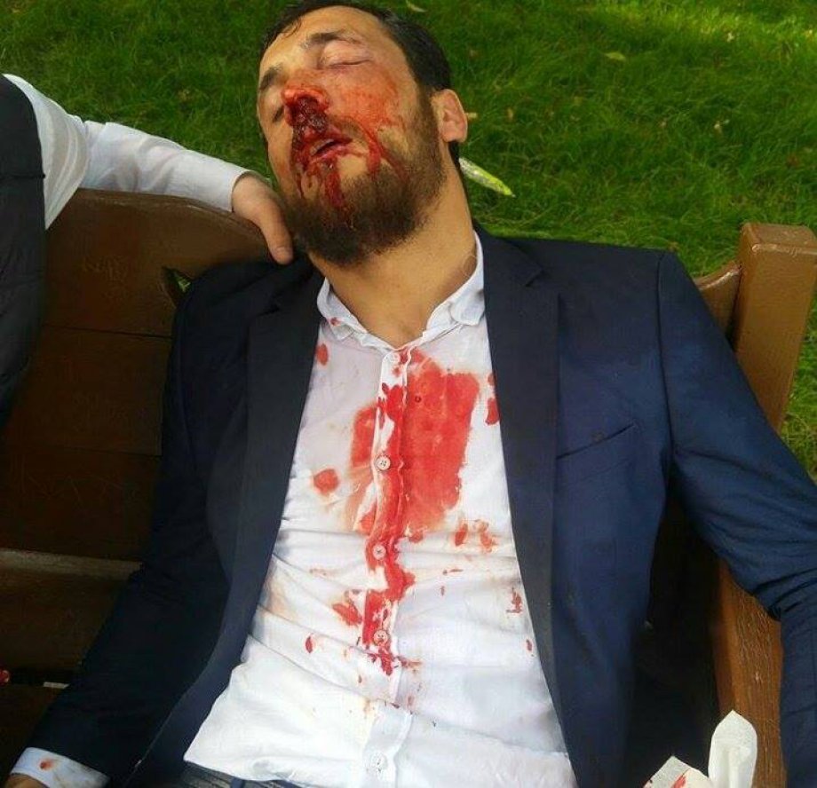 Furkan Vakfı Mensuplarına Acımasız Müdahale Anından Kareler