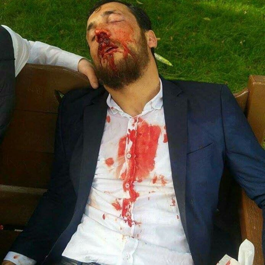 Furkan Vakfı Mensuplarına Acımasız Müdahale Anından Kareler