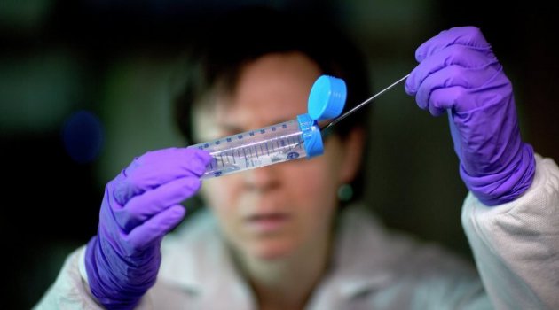 Antibiyotiklere karşı direnç kazanan bakteri keşfedildi
