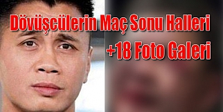 İşte Dövüşçülerin Maç Sonu Halleri (Foto Galeri) +18