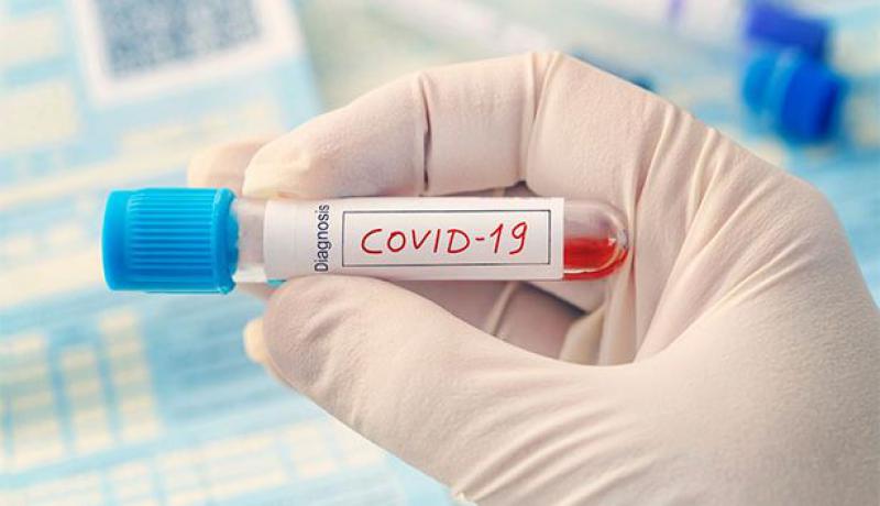 Rusya'da 10 bin 598 kişide daha koronavirüs tespit edildi