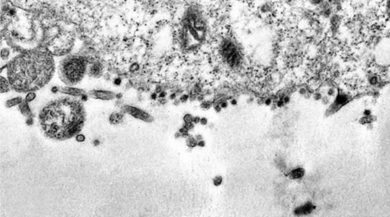 Koronavirüs'ün Saldırı Anı Görüntülendi