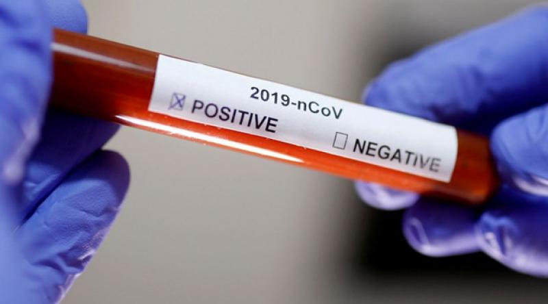 Belçika'da 12 yaşındaki çocuk koronavirüs nedeniyle hayatını kaybetti