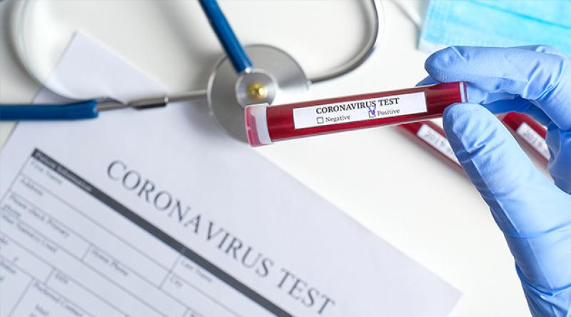 Moldova'da ilk koronavirüs vakası