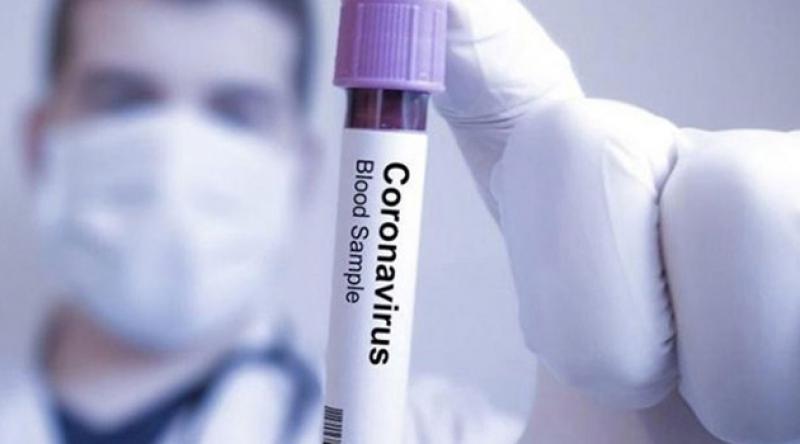 İtalya'da koronavirüsten dolayı hayatını kaybedenlerin sayısı bini aştı