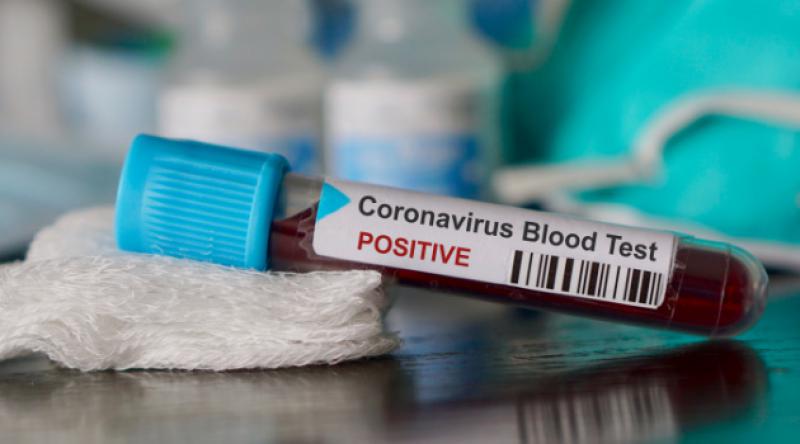Bir Avrupa ülkesinde daha Koronavirüs görüldü