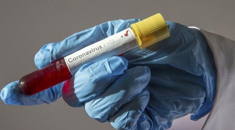 Fransa'da koronavirüs nedeniyle son 24 saatte 178 kişi yaşamını yitirdi