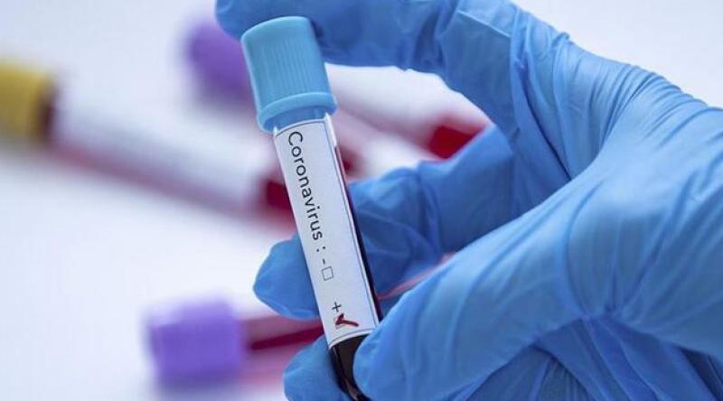 Fransa'da koronavirüs nedeniyle ölenlerin sayısı 21 bin 340'a yükseldi