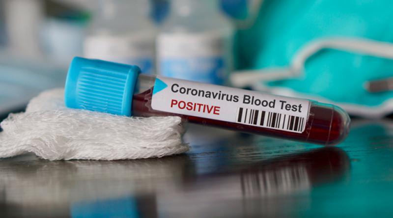 Gürcistan'da da ilk Koronavirüs vakası doğrulandı!