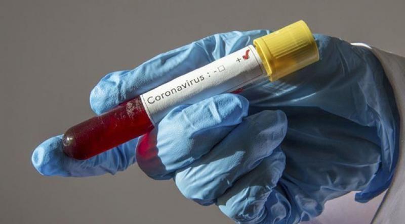 Dünya genelinde koronavirüs nedeniyle hayatını kaybedenlerin sayısı 60 bini aştı