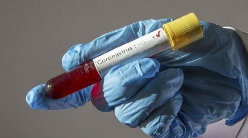 Fransız doktorlar: Sıtma ilacı Covid-19 tedavisinde işe yarıyor