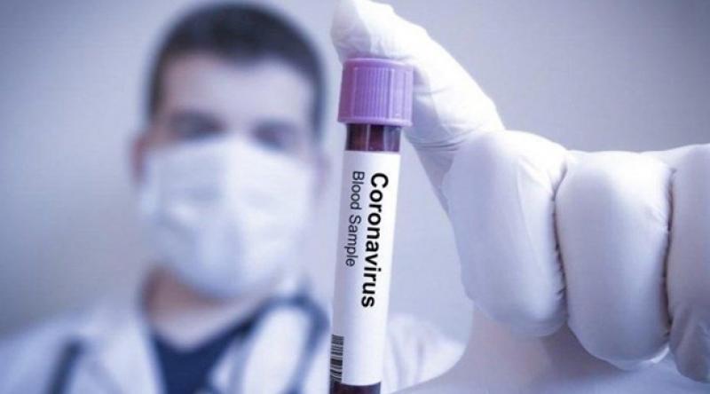 Corona virüsü sebebiyle son bir saatte 57 kişi öldü