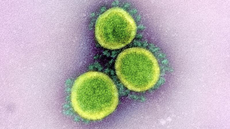 Koronavirüsün insan hücrelerinde yayılışı mikroskopla görüntülendi