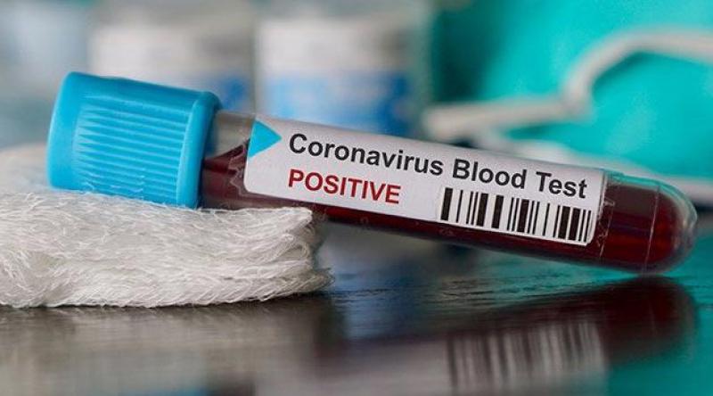 Belçika'da koronavirüs vaka sayısı 22 bini aştı