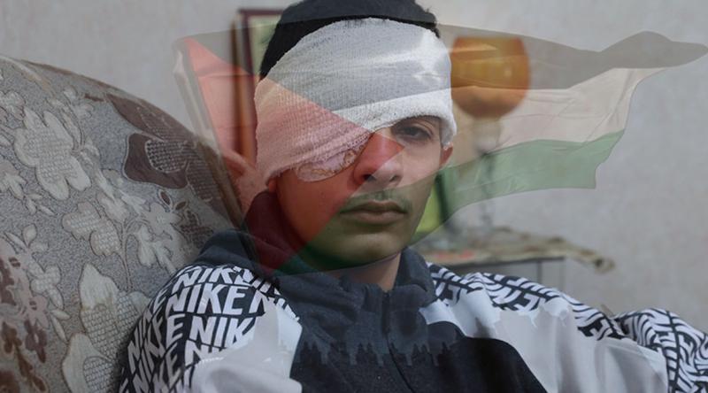 İsrail zulmü bitmiyor! Filistinli çocuk gözünü kaybetti