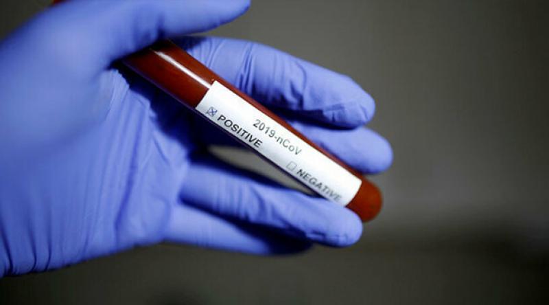 Fransa'da koronavirüs nedeniyle ölenlerin sayısı 20 bini aştı