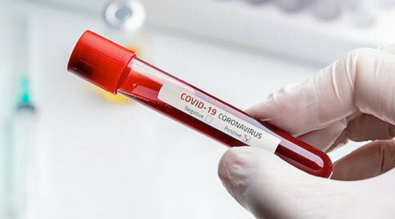 Fransa'da koronavirüsten hayatını kaybedenlerin sayısı 12 bin 210'a yükseldi