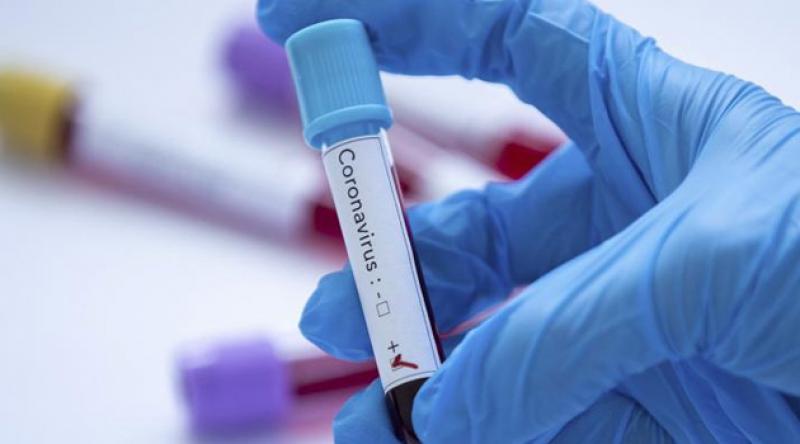 İngiltere'de koronavirüs nedeniyle ölenlerin sayısı 13 bin 729'a yükseldi
