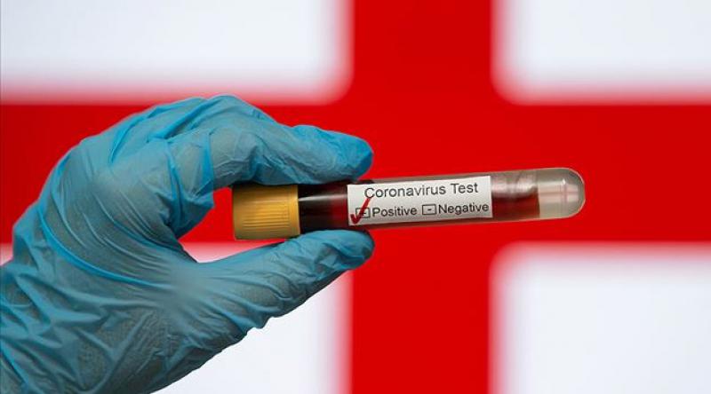 İngiltere'de koronavirüs nedeniyle ölenlerin sayısı 31 bin 855'e yükseldi