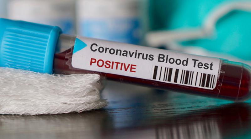 Irak'ta ilk koronavirüs vakası görüldü