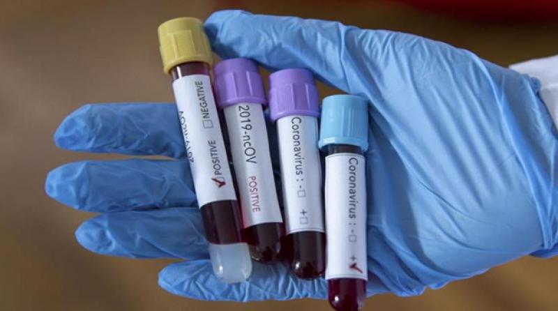 İspanya'da koronavirüsten ölenlerin sayısı 10 bin 935'e çıktı