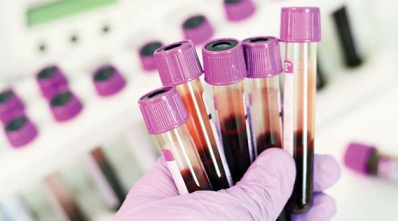 Çinli araştırmacılar, belirtiler görülmeden kanseri tespit eden kan testi geliştirdi