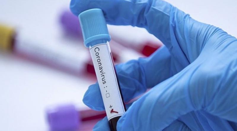 Koronavirüs testi hangi hastanelerde yapılıyor?