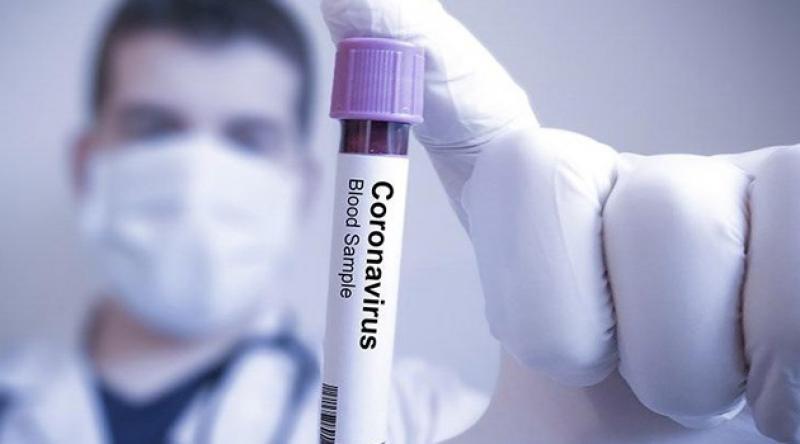 Suriye'de ilk koronavirüs vakası tespit edildi