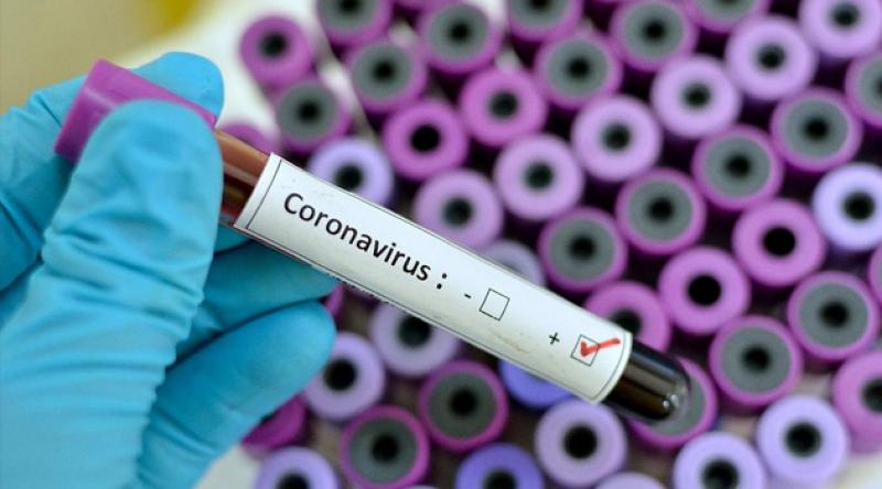 Dünya genelinde koronavirüs vaka sayısı 5 milyonu aştı