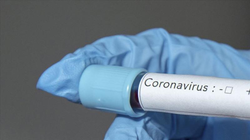 Hindistan'da koronavirüs nedeniyle sokağa çıkma yasağı ilan edildi