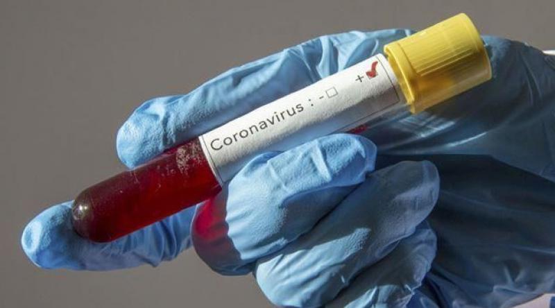 İran'da koronavirüsten ölenlerin sayısı 2 bin 234'e çıktı