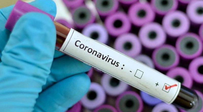 İtalya'da koronavirüsten hayatını kaybedenlerin sayısı son 24 saatte 610 artarak 18 bin 279'a yükseldi