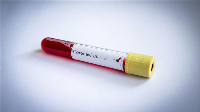 Yeni tip koronavirüs hakkında doğru bilinen yanlışlar