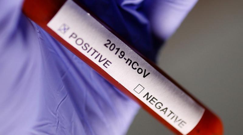 Fransa'da koronavirüs nedeniyle ölenlerin sayısı son 24 saatte 499 artarak 3 bin 523'e yükseldi