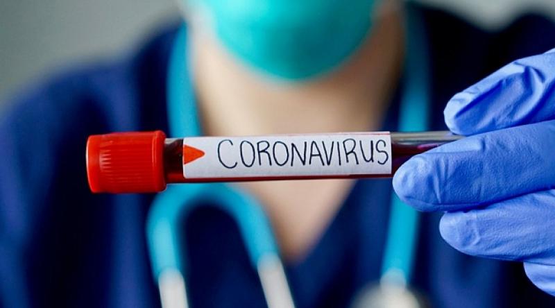 Dünyada koronavirüs bulaşan kişi sayısı 81 bini aştı