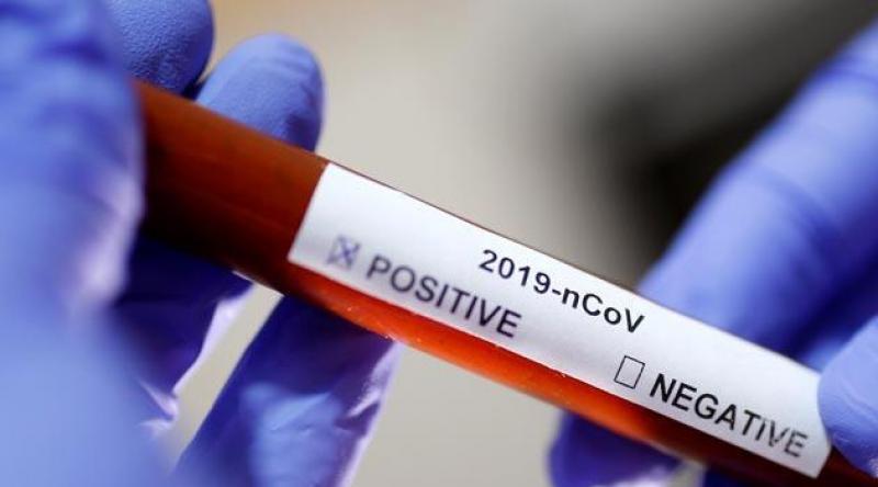 Suudi Arabistan'da koronavirüs vaka sayısı 511'e yükseldi