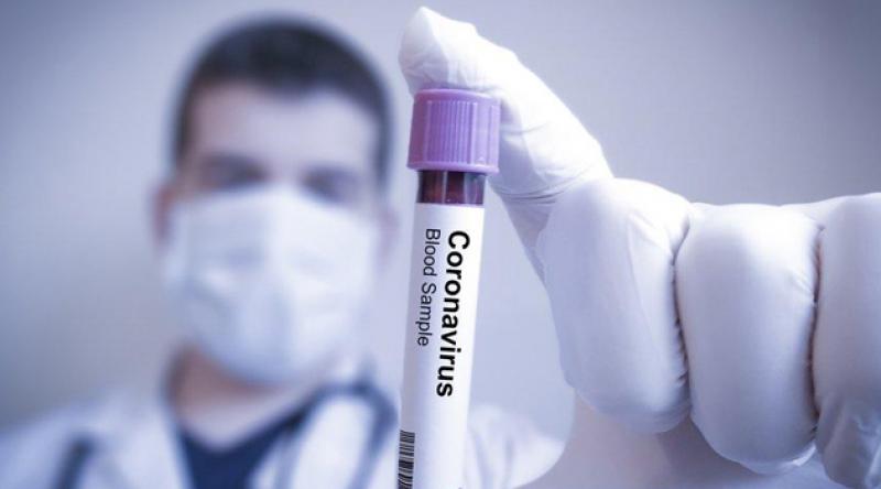Koronavirüs tanı kitinin doğruluk oranı yüzde 40 çıktı!