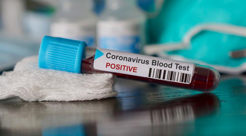 Özbekistan’da ilk koronavirüs vakası