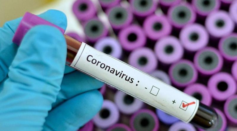 Avustralya'da koronavirüs ölümleri arttı