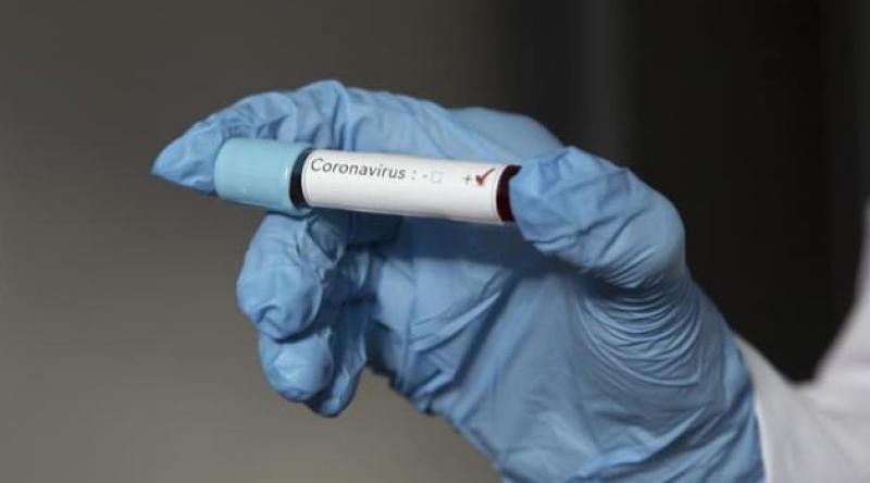 Dünya genelinde koronavirüs bulaşan sayısı artıyor: Sayı 2 milyon 184 bini geçti
