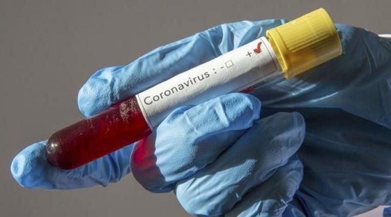 Koronavirüs nedeniyle ölenlerin sayısı dünya genelinde 30 bini aştı