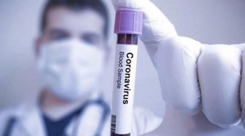 Japonya'da koronavirüs vaka sayısı 731'e yükseldi