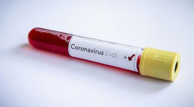 Kıbrıs'ta koronavirüsten ilk ölüm, Gazze'de ilk vaka