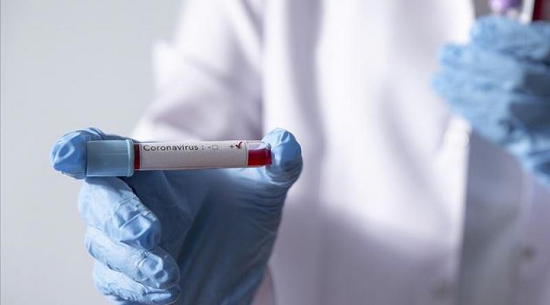 KKTC'de koronavirüs vaka sayısı 47’ye yükseldi