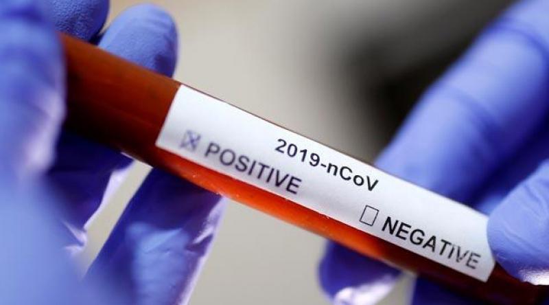 Çin'de koronavirüs salgını nedeniyle ölenlerin sayısı 259'a yükseldi